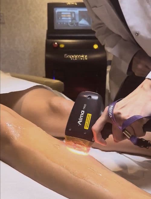 Laser hair removal in Malta