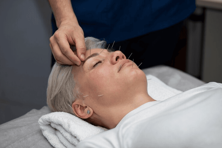 Facial Acupressure: Unlocking Youthful Radiance