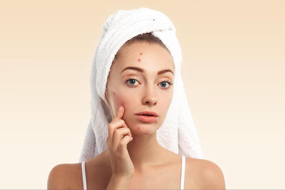 Advanced Hydrating Facials for Acne-Prone Skin: Benefits and Considerations